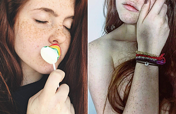 9 meninas que vão te fazer amar (ainda) mais suas sardas naturais