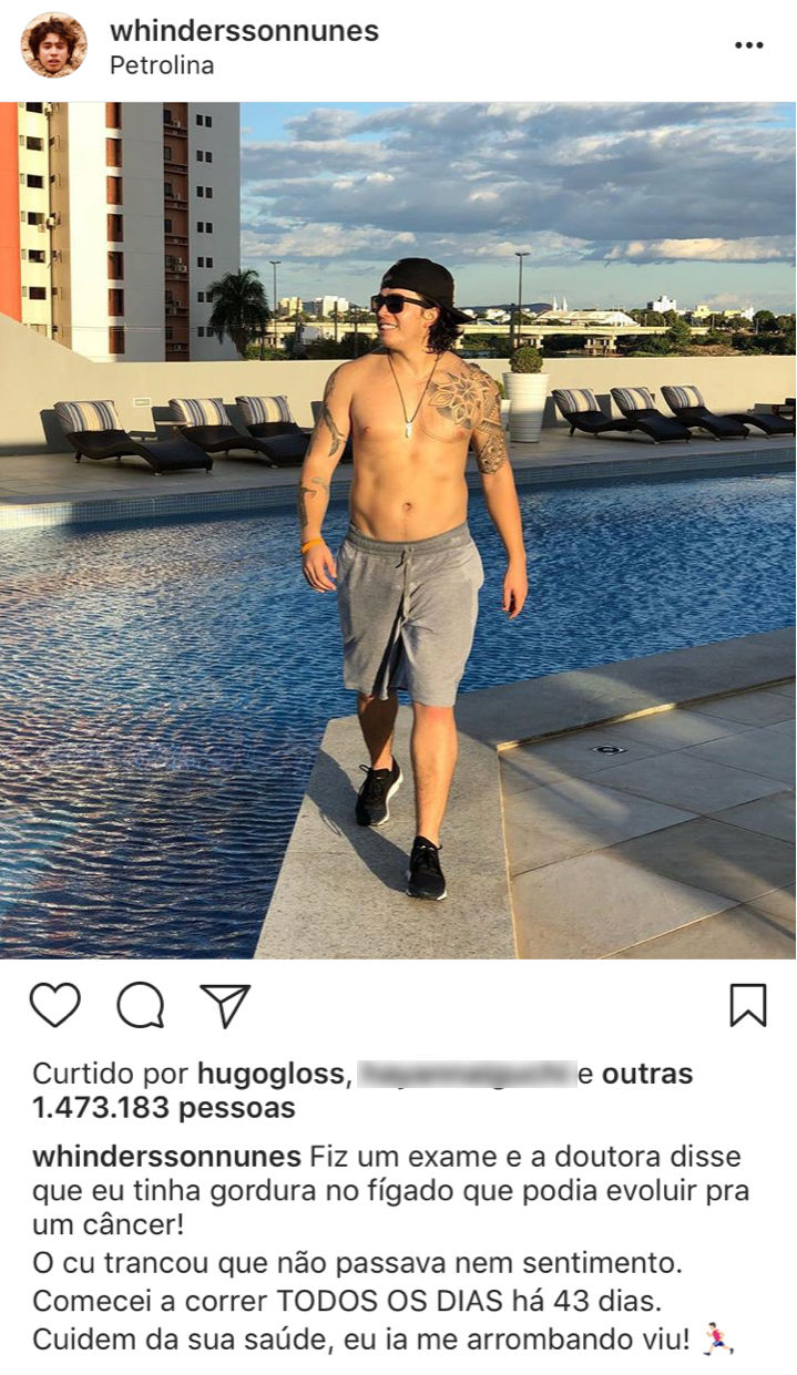 whindersson-nunes-descobre-gordura-no-figado whindersson-nunes-descobre-gordura-no-figado