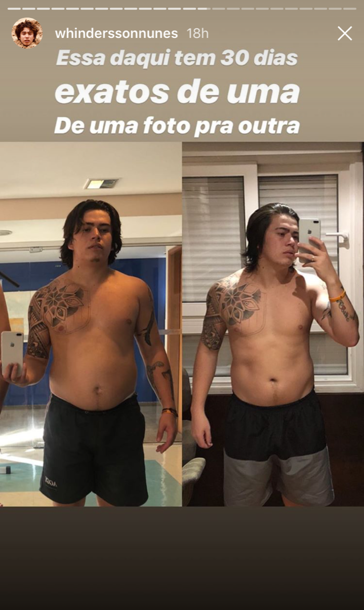 whindersson-nunes-gordura-figado-antes-e-depois whindersson-nunes-gordura-figado-antes-e-depois
