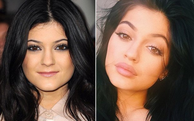 boca-kylie-jenner-maquiagem-preenchimento56100 boca-kylie-jenner-maquiagem-preenchimento56100