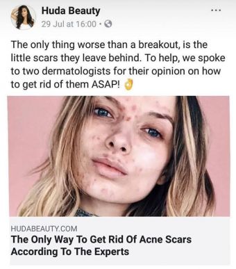 huda-beauty-espinhas-acne huda-beauty-espinhas-acne