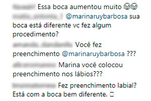 marina-ruy-barbosa-fas-questionam-preenchimento-labios marina-ruy-barbosa-fas-questionam-preenchimento-labios