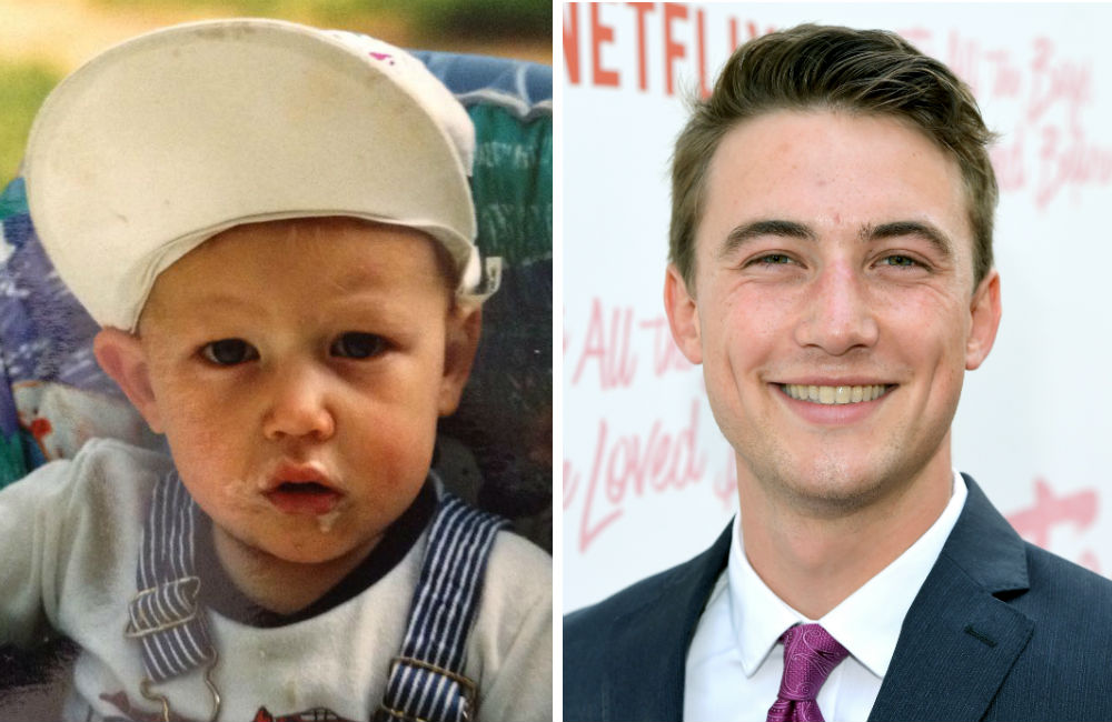 jordan-burtchett–antes-e-depois-para-todos-os-garotos jordan-burtchett--antes-e-depois-para-todos-os-garotos