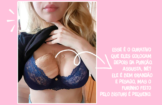 O dia em que eu descobri que poderia estar com câncer de mama