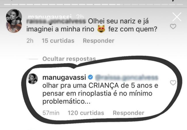 manu-gavassi-resposta-rinoplastia-1 manu-gavassi-resposta-rinoplastia-1