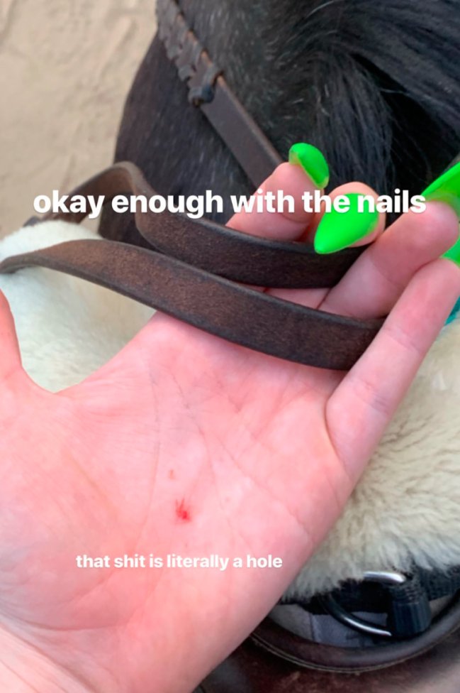 billie-eilish-unha-verde-machucado billie-eilish-unha-verde-machucado