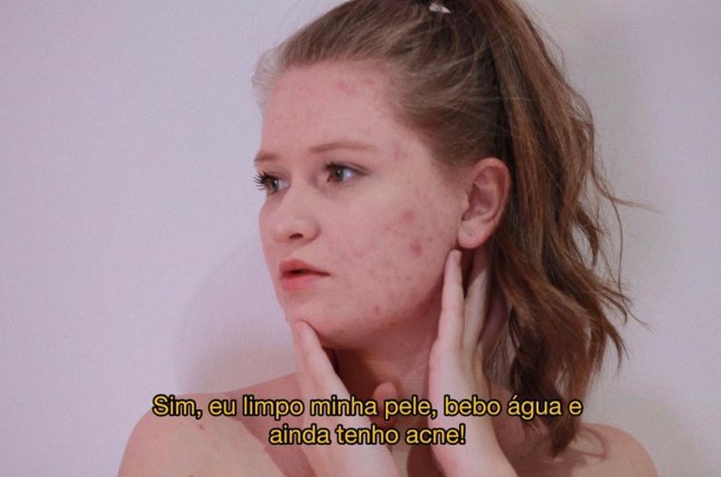 Keren Paiva skin positivity 3
