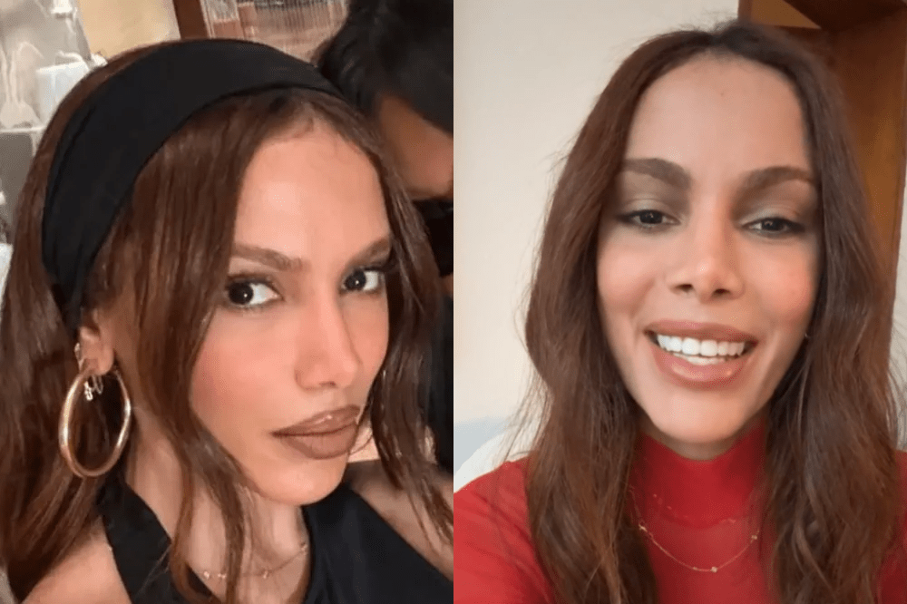Montagem mostra novo rosto de Anitta em dois momentos diferentes
